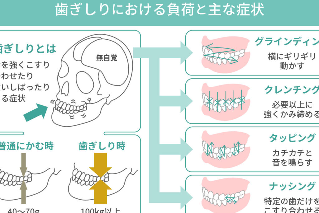 骨隆起は何人に1人？その発生率と影響を解説